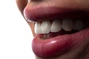 Comment surmonter la peur du dentiste ? Conseils et solutions